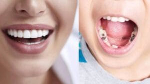Dental Problems