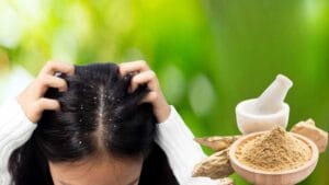 Multani Mitti for Dandruff / খুশকির জন্য মুলতানি মাটির উপকারিতা